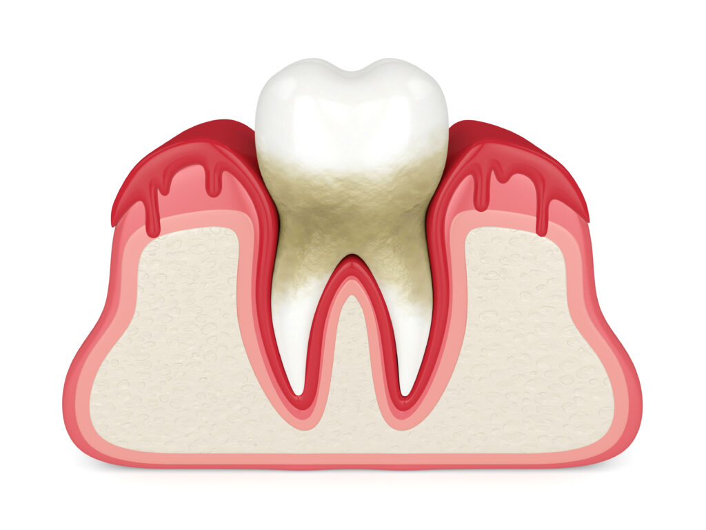 27615 periodontal dentist